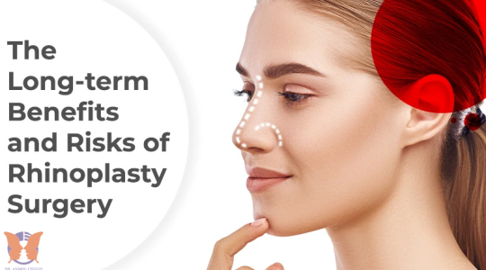 Rhinoplasty side effects and recovery process after nose surgery