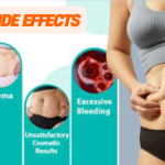 Tummy tuck recovery and side effects guide