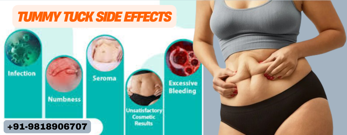 Tummy tuck recovery and side effects guide