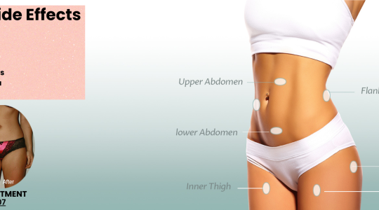 Understanding liposuction side effects and recovery process