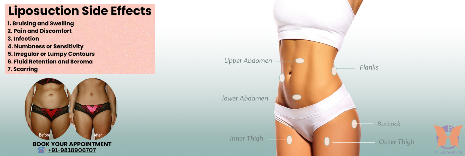 Understanding liposuction side effects and recovery process