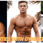 Famous celebrities with gynecomastia and their transformation