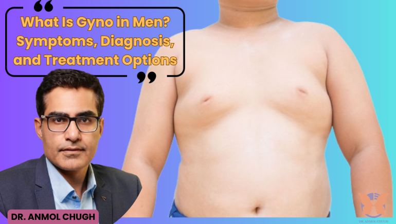 What Is Gyno in Men? Symptoms, Diagnosis, and Treatment Options