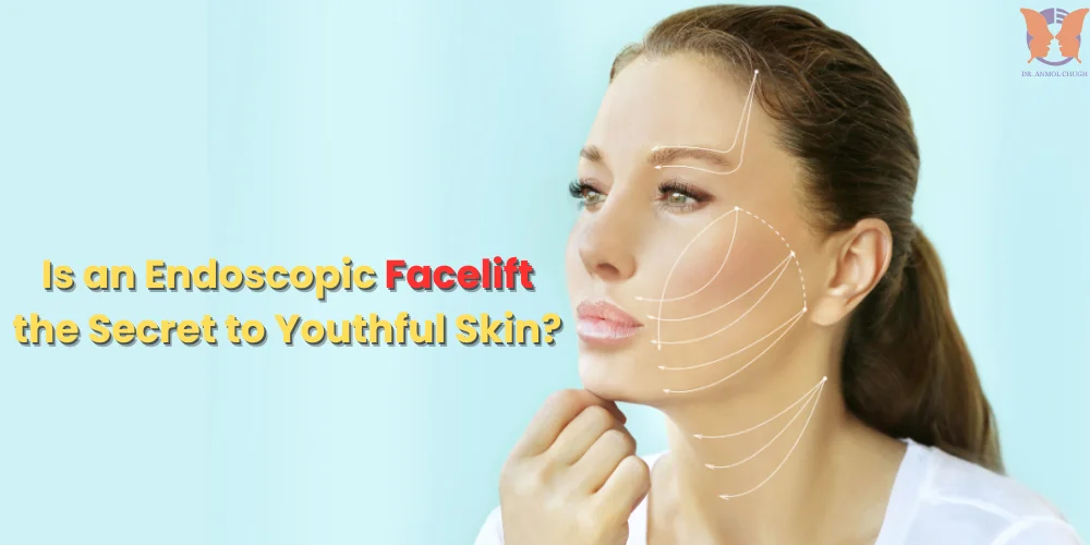 A minimally invasive procedure for youthful lifted skin