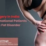 Lipedema Surgery in India – Specialized Care for International Patients with Chronic Fat Disorder