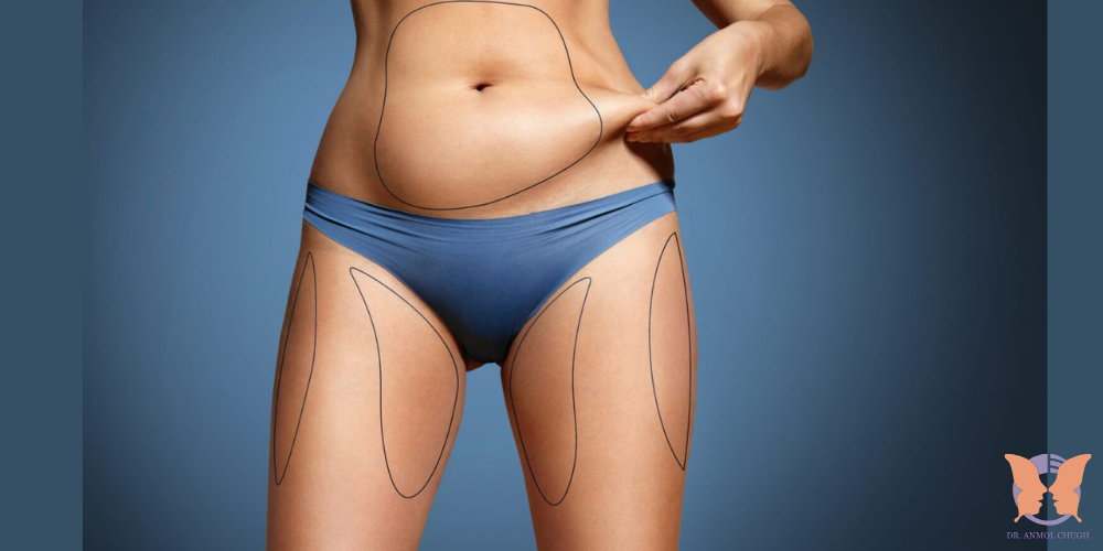 Understanding the pros and cons of liposuction – safe fat removal and body contouring options Understanding the pros and cons of liposuction – safe fat removal and body contouring options