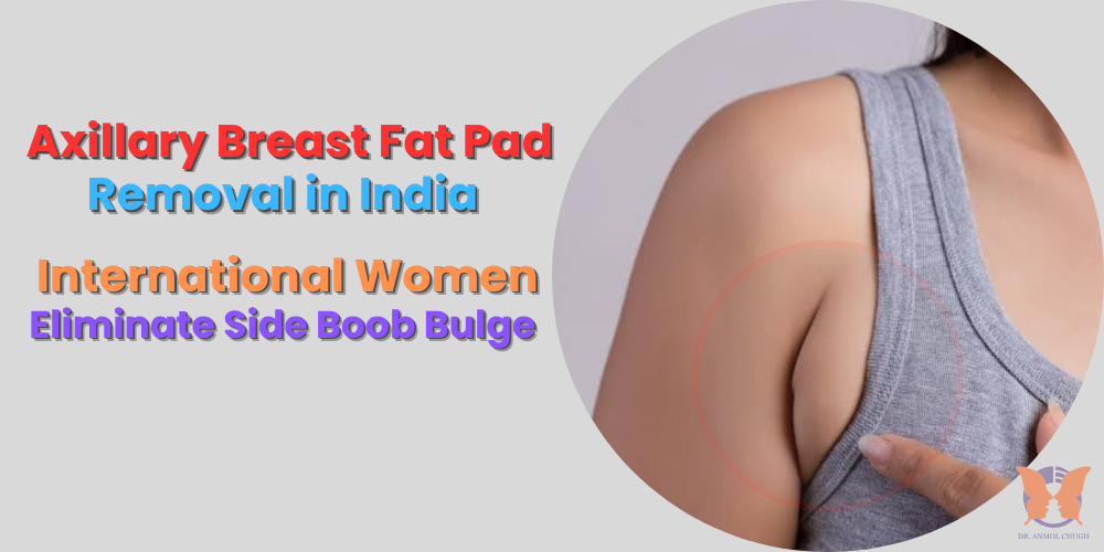 Axillary breast fat pad removal before and after in India – contouring side boob and underarm area