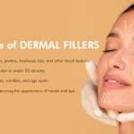 Benefits of Fillers: How They Can Enhance Your Look