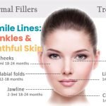 Fillers for Smile Lines: Smooth Out Wrinkles Effectively