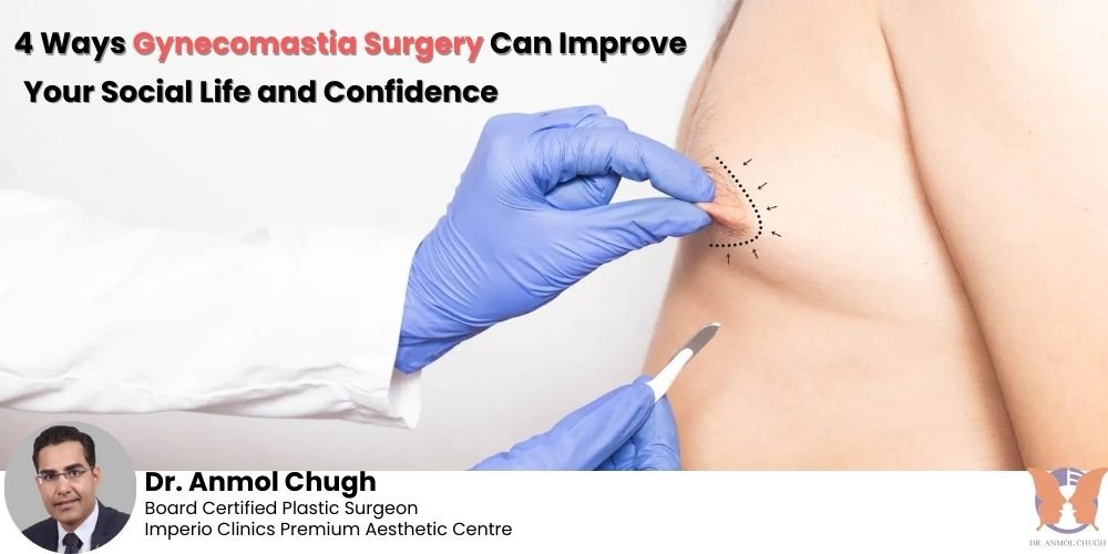 Gynecomastia surgery benefits – boosting social life and confidence