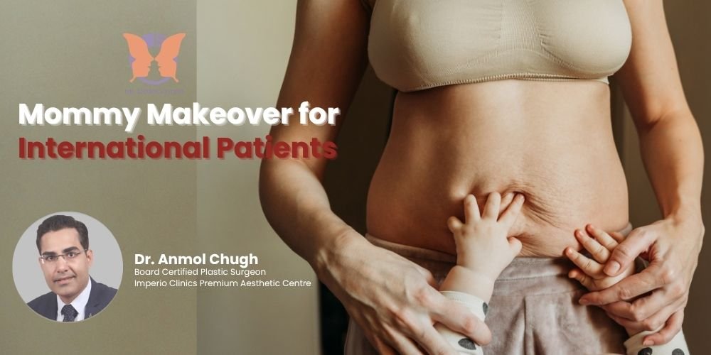 Mommy Makeover for International Patients