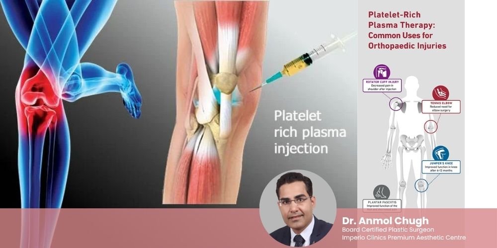 PRP for Sports Injuries: Why Athletes Swear by It