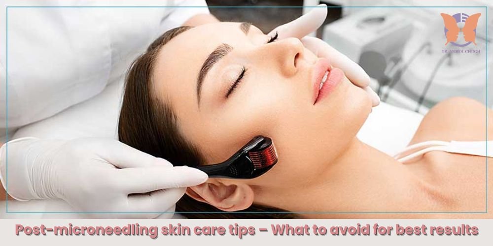 Post-microneedling skin care tips – What to avoid for best results Post-microneedling skin care tips – What to avoid for best results