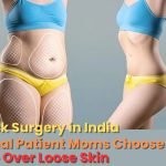 Tummy Tuck in India: Why International Moms Choose Confidence Over Loose Skin
