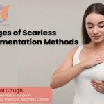 8 Advantages of Scarless Breast Augmentation Methods