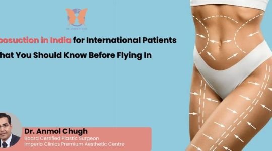 Liposuction in India for International Patients: What You Should Know Before Flying In
