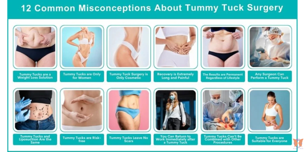 Tummy tuck surgery safety guide – patient preparing for a safe abdominoplasty procedure
