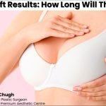Breast Lift Results: How Long Will They Last?
