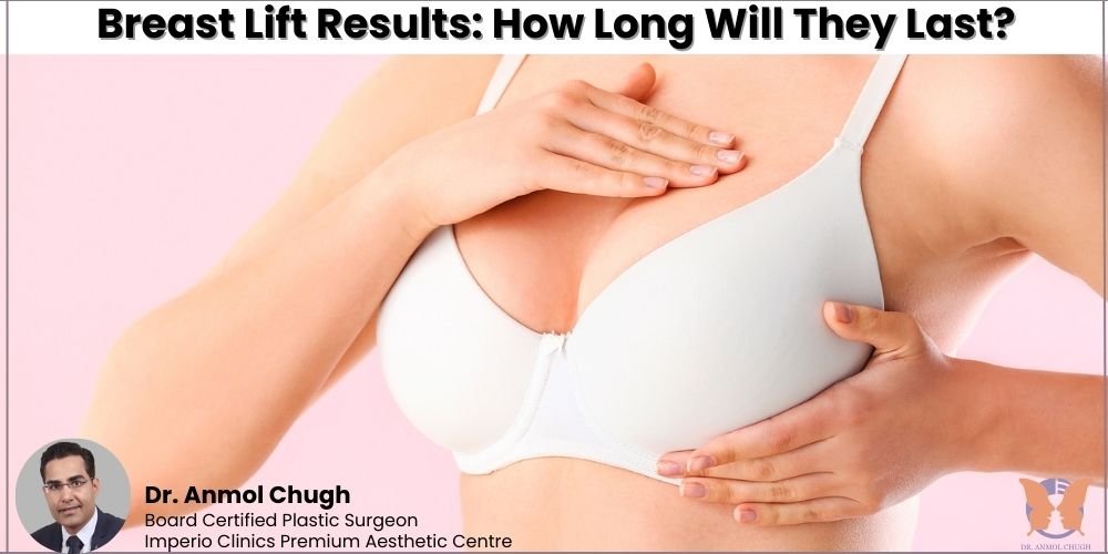 Breast Lift Results: How Long Will They Last?