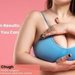 Breast Reduction Results: Health Benefits You Can Expect