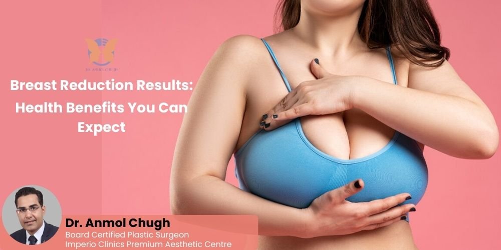 Breast Reduction Results: Health Benefits You Can Expect