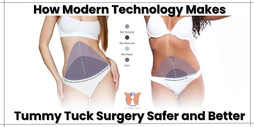 Modern tummy tuck surgery in India – Safe techniques with natural results
