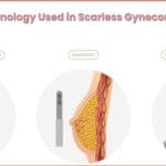 Scarless gynecomastia surgery in India using advanced science and technology for natural chest contour