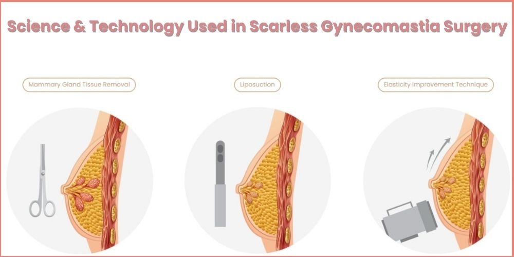 Scarless gynecomastia surgery in India using advanced science and technology for natural chest contour
