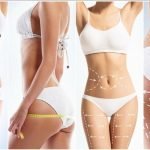 The Role of Science and Technology in Liposuction Success