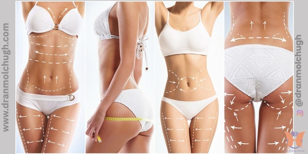 The Role of Science and Technology in Liposuction Success
