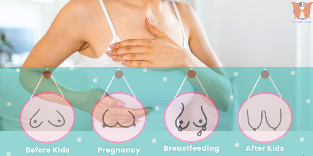 Post pregnancy breast care natural ways to prevent breast sagging and maintain firmness Post pregnancy breast care – natural ways to prevent breast sagging and maintain firmness