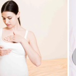 When Should You See a Doctor After Pregnancy for Breast Change When Should You See a Doctor After Pregnancy for Breast Changes