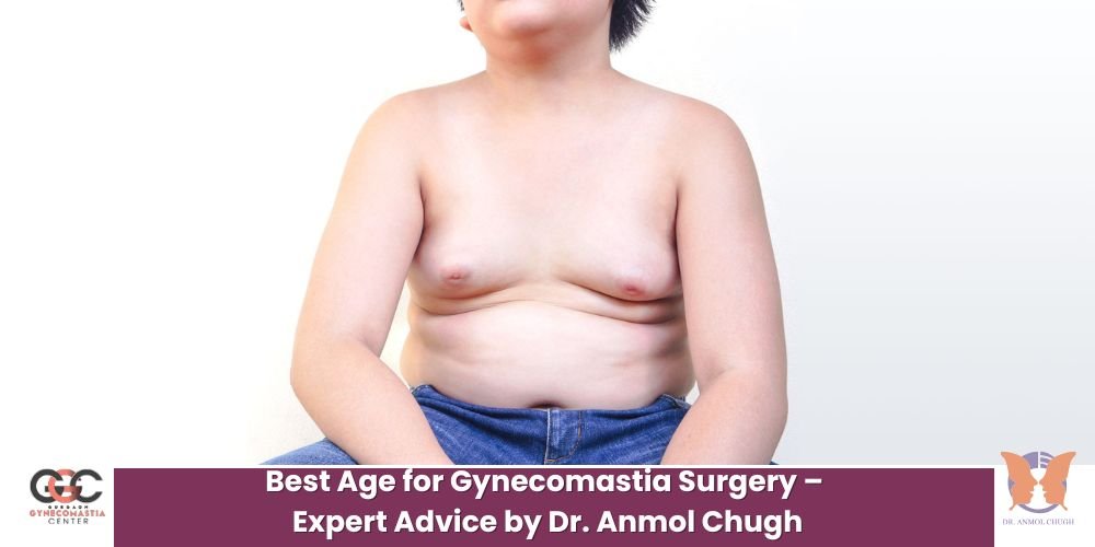 Best age for gynecomastia surgery – Expert advice by Dr. Anmol Chugh