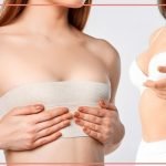 Freedom from Pain, Not Femininity - Why Women Choose Breast Reduction