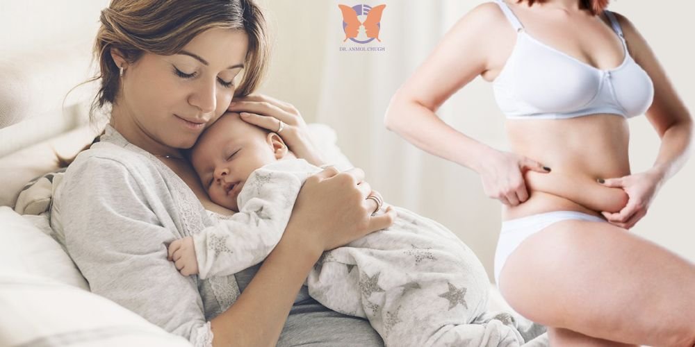 Healing After Motherhood The True Purpose of a Tummy Tuck Healing After Motherhood: The True Purpose of a Tummy Tuck