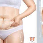 Liposuction Is Not a Shortcut - It’s a Shape Refinement
