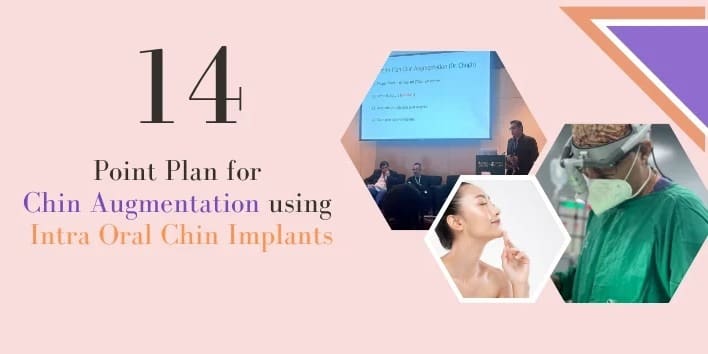 14 Point Plan for Chin Augmentation using Intra Oral Chin Implants