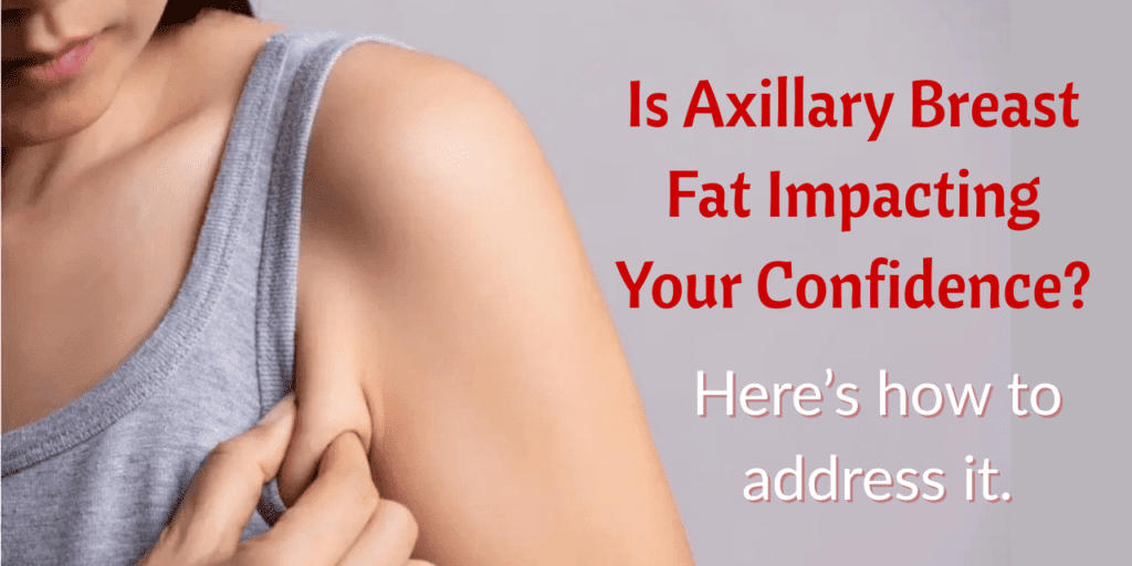 Is Axillary Breast Fat Impacting Your Confidence?