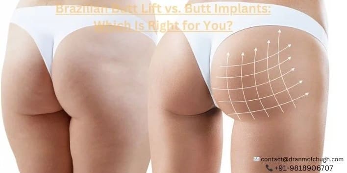 Brazilian Butt Lift vs Butt Implants Which Is Right for You