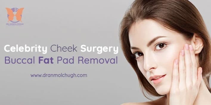 Celebrity Cheek Surgery Buccal fat pad removal