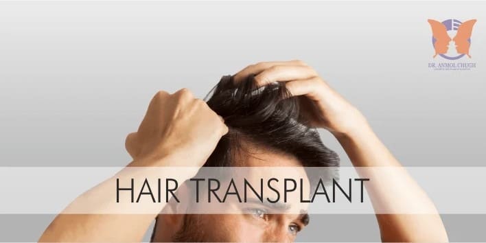 Hair-Transplant