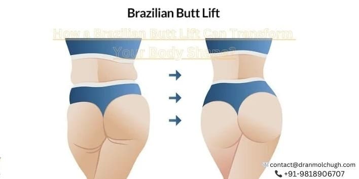 How a Brazilian Butt Lift Can Transform Your Body Shape