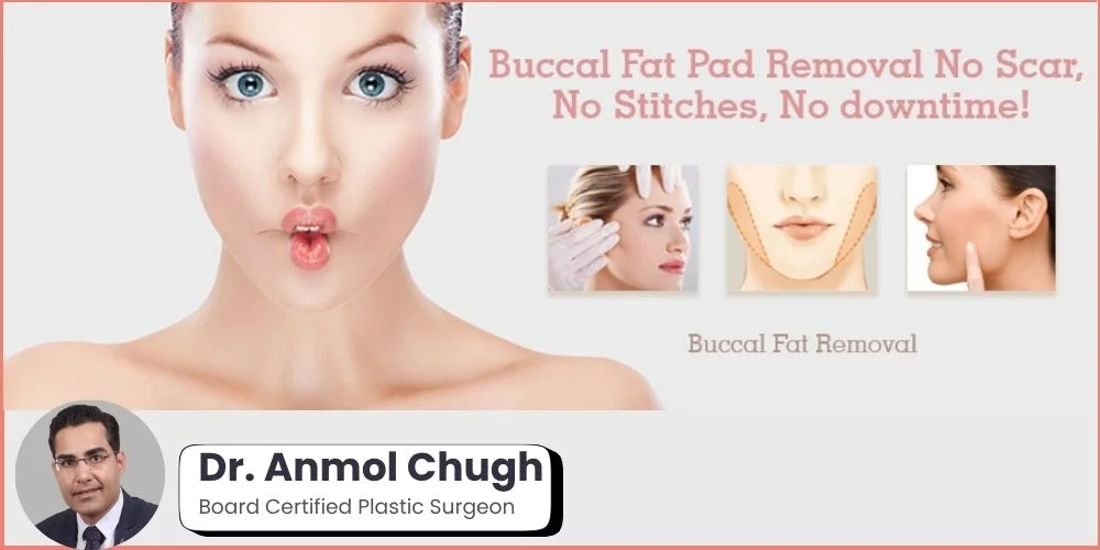 Post buccal fat removal care swelling reduction and skin healing tips