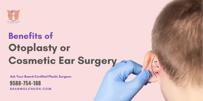 What is Otoplasty Why is it Beneficial