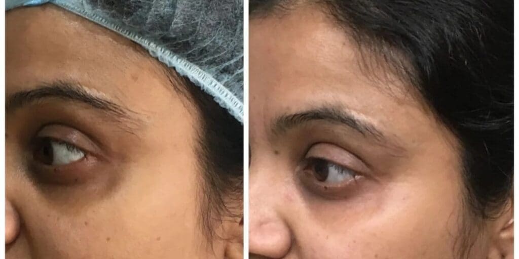 Patient Result