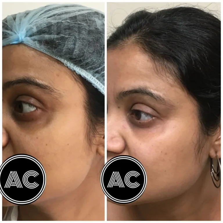 Patient Result