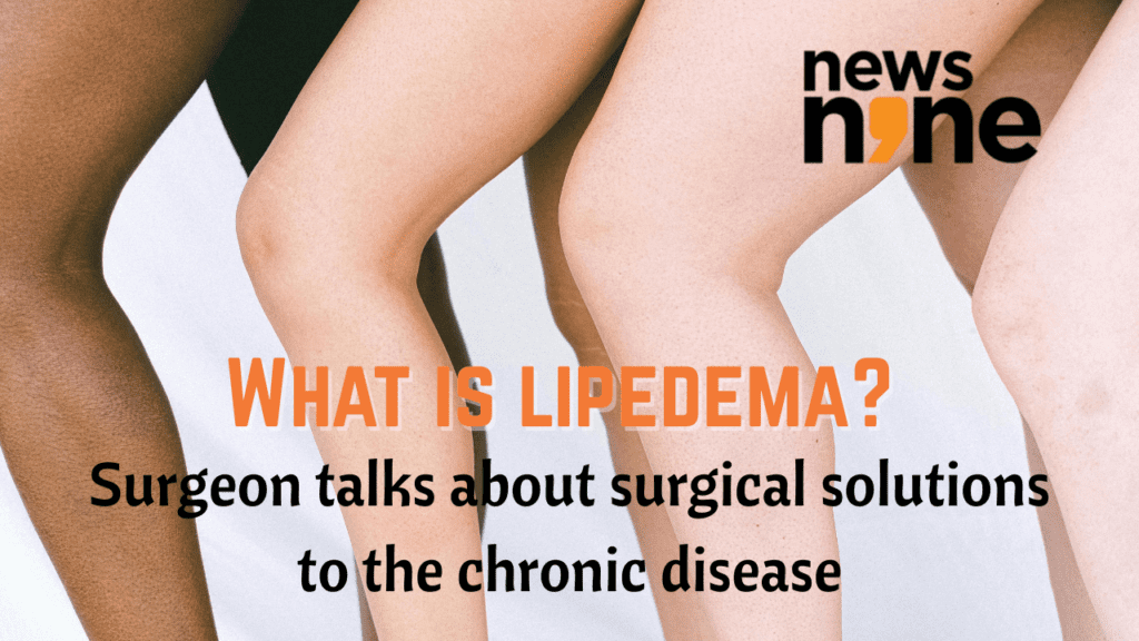 What is lipedema? Surgeon talks about solutions to the chronic disease