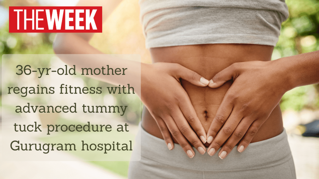36 year old mother regains fitness with advance tummy tuck procedure at Gurugram hospital