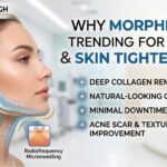 Morpheus8 treatment for jawline contouring and skin tightening